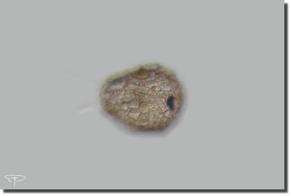 foto tecameba difflugia