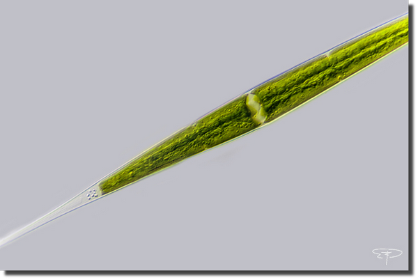 foto closterium kutzingii