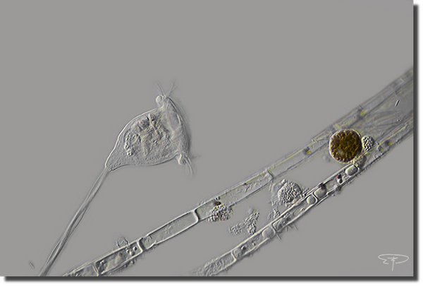 foto vorticella