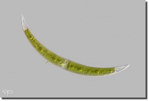 foto closterium leibleinii