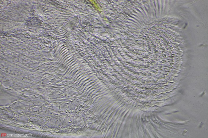 citostoma