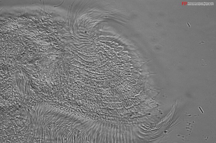 citostoma