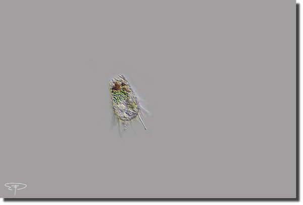 foto tecameba euglypha